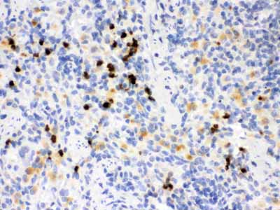 2 - Anti-MMP-8 Antibody ABO12413