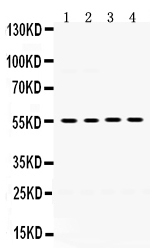 1 - Anti-MMP-8 Antibody ABO12413