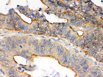 2 - Anti-OSM/Oncostatin M Antibody ABO12418