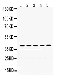 1 - Anti-OSM/Oncostatin M Antibody ABO12418