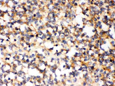 2 - Anti-PAK5 Picoband Antibody ABO12419