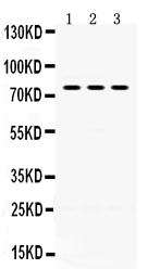 1 - Anti-PAK5 Picoband Antibody ABO12419