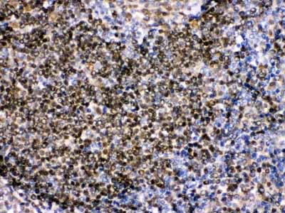2 - Anti-Pax2 Picoband Antibody ABO12420