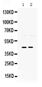 1 - Anti-Pax2 Picoband Antibody ABO12420