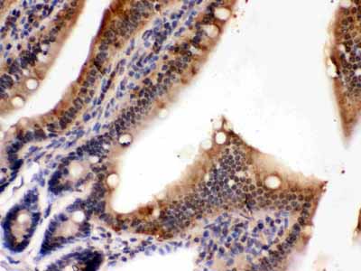 2 - Anti-PDPK1 Picoband Antibody ABO12421