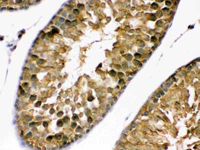 2 - Anti-PDPK1 Picoband Antibody ABO12421