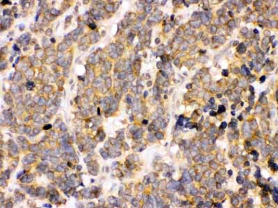 2 - Anti-PDPK1 Picoband Antibody ABO12421