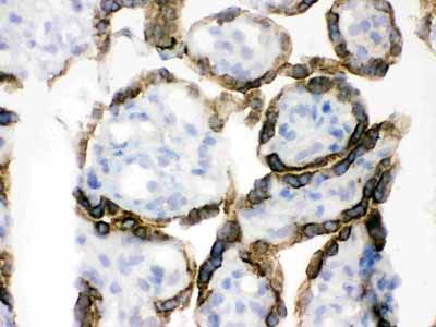 2 - Anti-PDPK1 Picoband Antibody ABO12421
