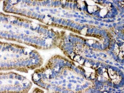 2 - Anti-PDPK1 Picoband Antibody ABO12421