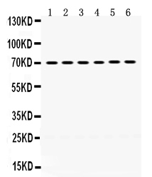 1 - Anti-PDPK1 Picoband Antibody ABO12421