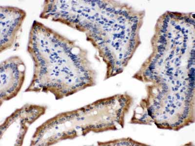 2 - Anti-POR Picoband Antibody ABO12422