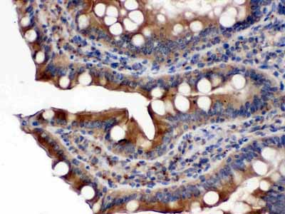 2 - Anti-POR Picoband Antibody ABO12422