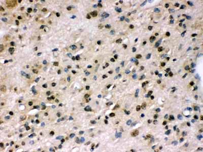 2 - Anti-PPP1R12A Picoband Antibody ABO12423
