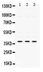 1 - Anti-AMPK Beta 1 Picoband Antibody ABO12424