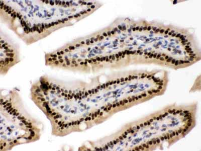2 - Anti-AMPK Beta 2 Picoband Antibody ABO12425