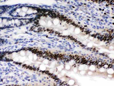 2 - Anti-AMPK Beta 2 Picoband Antibody ABO12425