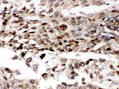 2 - Anti-AMPK Beta 2 Picoband Antibody ABO12425