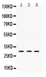 1 - Anti-AMPK Beta 2 Picoband Antibody ABO12425