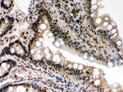 2 - Anti-c-Rel Picoband Antibody ABO12427