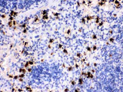2 - Anti-S100A8 Antibody ABO12428