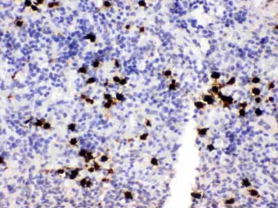 2 - Anti-S100A8 Antibody ABO12428