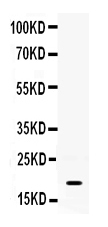 1 - Anti-S100A8 Antibody ABO12428