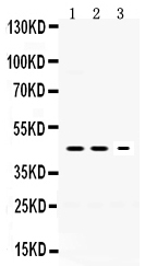 1 - Anti-Neuroserpin Picoband Antibody ABO12430