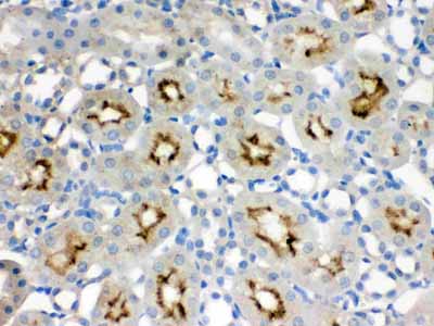 2 - Anti-SMC3 Picoband Antibody ABO12432