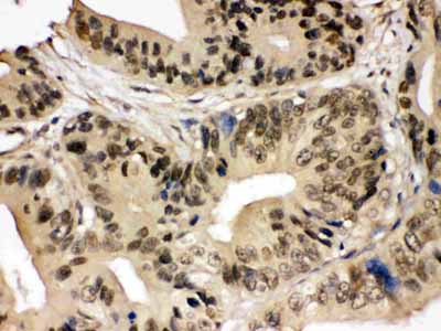 2 - Anti-SMC3 Picoband Antibody ABO12432