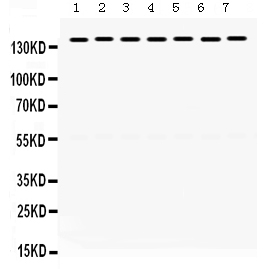 1 - Anti-SMC3 Picoband Antibody ABO12432