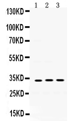 1 - Anti-SOD3 Picoband Antibody ABO12433
