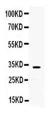 1 - Anti-TREX1 Picoband Antibody ABO12434