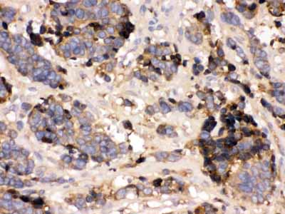 2 - Anti-Prealbumin Picoband Antibody ABO12435