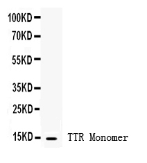 1 - Anti-Prealbumin Picoband Antibody ABO12435