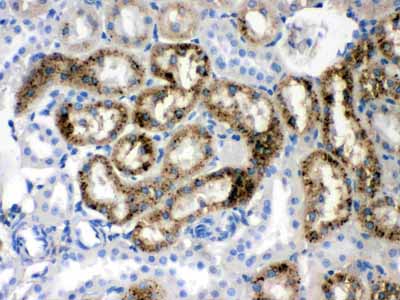 2 - Anti-Prealbumin Picoband Antibody ABO12436