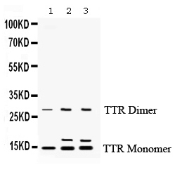 1 - Anti-Prealbumin Picoband Antibody ABO12436