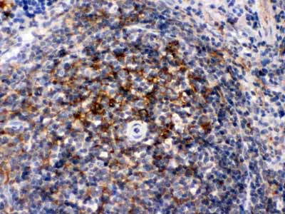 2 - Anti-Actin Picoband Antibody ABO12437