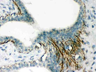 2 - Anti-Actin Picoband Antibody ABO12437