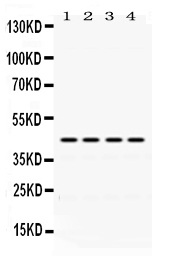 1 - Anti-Actin Picoband Antibody ABO12437