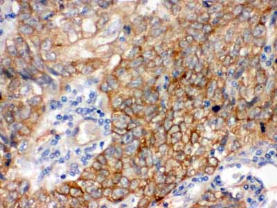 2 - Anti-Bag3 Picoband Antibody ABO12440