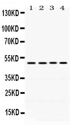 1 - Anti-DDB2 Picoband Antibody ABO12443