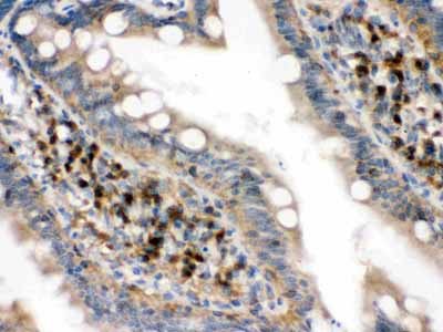 2 - Anti-eIF4A2 Picoband Antibody ABO12444
