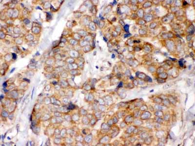 2 - Anti-eIF4A2 Picoband Antibody ABO12444