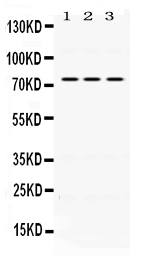 1 - Anti-IL2RB Picoband Antibody ABO12447