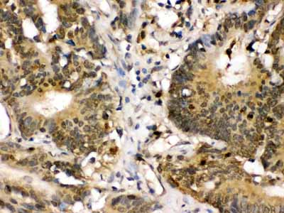 2 - Anti-MEK3 Picoband Antibody ABO12449