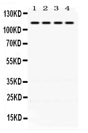1 - Anti-NR3C2 Picoband Antibody ABO12451