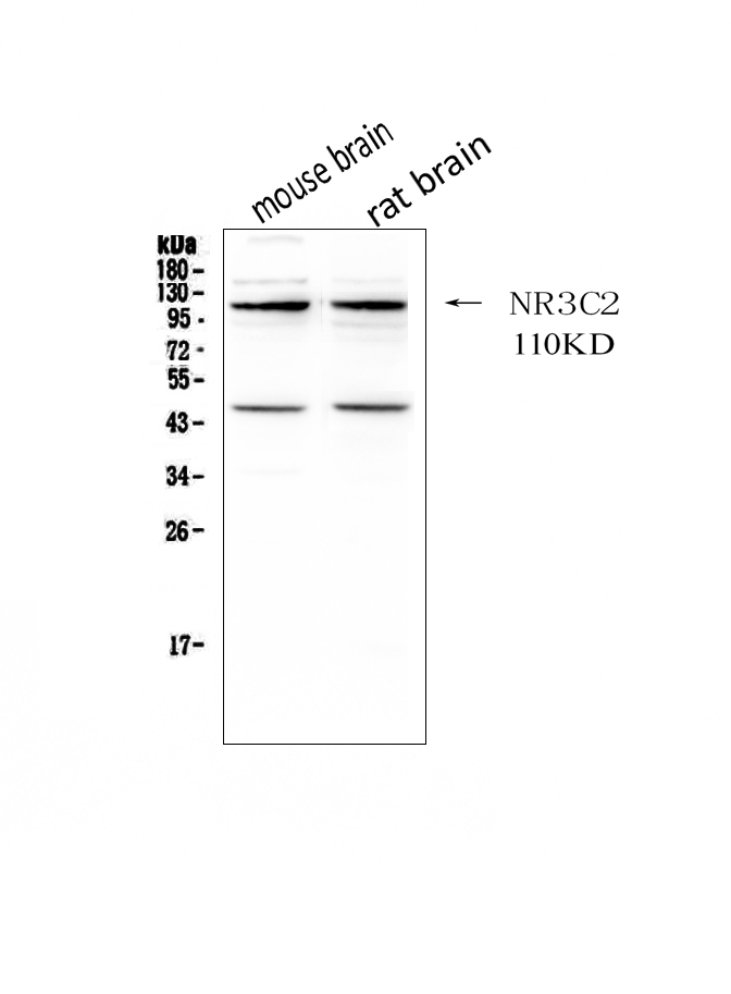 1 - Anti-NR3C2 Picoband Antibody ABO12451