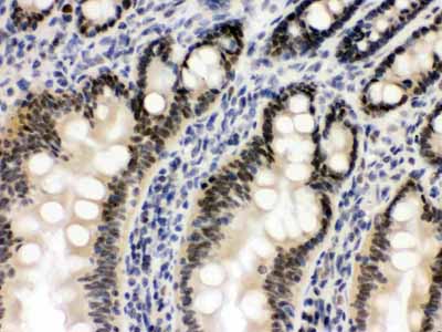 2 - Anti-OGT Picoband Antibody ABO12453