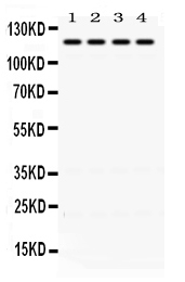1 - Anti-OGT Picoband Antibody ABO12453
