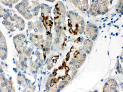2 - Anti-PAX6 Picoband Antibody ABO12454